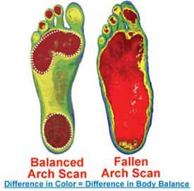 Foot Levelers Fallen Arch Scan
